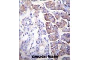 CPB1 Antibody (N-term) (ABIN655962 and ABIN2845347) immunohistochemistry analysis in formalin fixed and paraffin embedded human pancreas tissue followed by peroxidase conjugation of the secondary antibody and DAB staining.