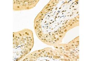 Immunohistochemistry of paraffin embedded rat bladder using PABPN1 (ABIN7075116) at dilution of 1:600 (400x lens) (PABPN1 anticorps)