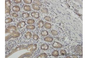Image no. 2 for anti-N-Myc (And STAT) Interactor (NMI) (AA 1-101) antibody (ABIN598595) (NMI anticorps  (AA 1-101))