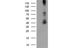 Western Blotting (WB) image for anti-Microtubule-Associated Protein, RP/EB Family, Member 2 (MAPRE2) antibody (ABIN1499315) (MAPRE2 anticorps)