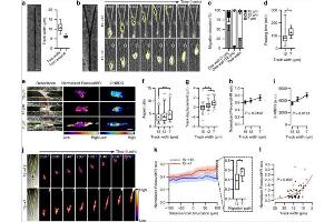 Spatial confinement influences migration decision-making, cellular ATP:ADP ratio, and glucose uptake.