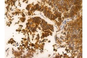 ABIN6262192 and ABIN6266561 at 1/100 staining human pituitary adenoma by IHC-P. (HDAC9 anticorps  (C-Term))