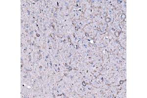 IHC analysis of FXR1 using anti-FXR1 antibody (ABIN7600093). (FXR1 anticorps  (AA 149-614))