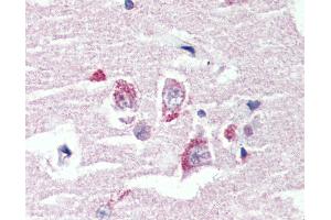 Anti-GPR98 antibody IHC of human brain, cortex. (ADGRV1 / GPR98 anticorps  (N-Term))