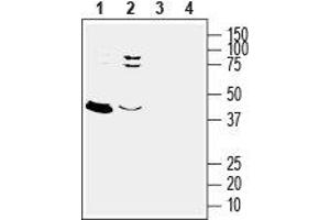 Western blot analysis of rat (lanes 1 and 3) and mouse (lanes 2 and 4) brain lysates: - 1,2. (GPER anticorps  (3rd Extracellular Loop))