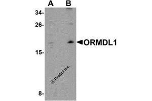 Western Blotting (WB) image for anti-ORM1-Like 1 (ORMDL1) antibody (ABIN1031784) (ORMDL1 anticorps)