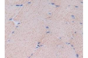 Detection of FN in Rat Skeletal muscle Tissue using Polyclonal Antibody to Fibronectin (FN)