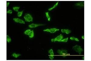 Immunofluorescence (IF) image for anti-Acid Phosphatase 2, Lysosomal (ACP2) antibody (ABIN781949) (ACP2 anticorps)
