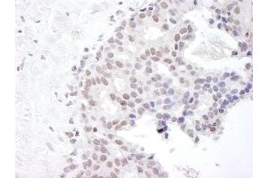 Immunohistochemistry (IHC) image for anti-Gem (Nuclear Organelle) Associated Protein 4 (GEMIN4) (C-Term) antibody (ABIN7448579)