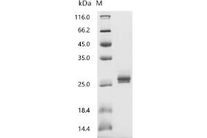 Interleukin 11 (IL11) (AA 22-199), (full length) protein (His tag)