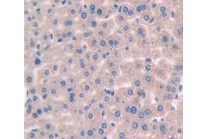 Figure. (IL-1 beta anticorps  (AA 118-269))