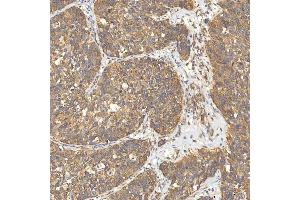 IHC analysis of Citrin/SLC25A13 using anti-Citrin/SLC25A13 antibody (ABIN7599512). (slc25a13 anticorps  (AA 1-643))