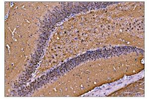 IHC analysis of CAMKIV/Camk4 using anti-CAMKIV/Camk4 antibody (ABIN7600419). (CAMK4 anticorps  (AA 19-469))