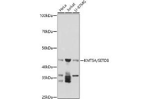 Western blot analysis of extracts of various cell lines, using (ABIN3019413, ABIN3019414, ABIN3019415 and ABIN6220892) at 1:1000 dilution.