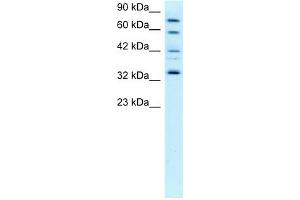 WB Suggested Anti-CDK7 Antibody Titration:  0.