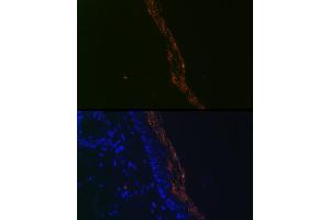 Immunofluorescence analysis of mouse skin cells using PERP Rabbit mAb (ABIN7270861) at dilution of 1:100 (40x lens). (PERP anticorps)