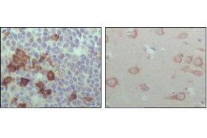 Immunohistochemical analysis of paraffin-embedded human lymph node (left) and brain (right), showing cytoplasmic localization with DAB staining using EhpB6 antibody. (EPH Receptor B6 anticorps  (AA 601-750))