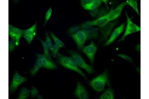 Image no. 6 for anti-Budding Uninhibited By Benzimidazoles 1 Homolog beta (Yeast) (BUB1B) antibody (ABIN1496996) (BUB1B anticorps)