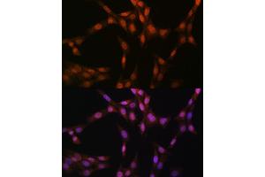 Immunofluorescence analysis of NIH-3T3 cells using Glutathione Synthetase (GSS) (GSS) Rabbit mAb (ABIN7267452) at dilution of 1:100 (40x lens). (Glutathione Synthetase anticorps)