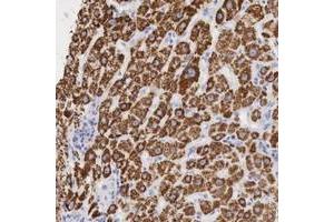 Immunohistochemical staining of human liver with OTC polyclonal antibody  shows cytoplasmic positivity in hepatocytes. (OTC anticorps  (AA 172-299))