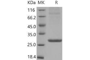 Western Blotting (WB) image for Amyloid P Component, Serum (APCS) (Active) protein (His tag) (ABIN7320402)