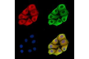 ABIN7095806 and ABIN7099868 staining Hela cells by IF/ICC.