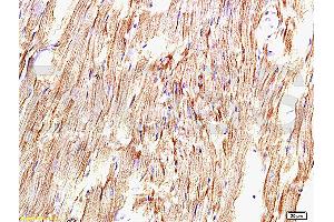 Formalin-fixed and paraffin embedded rat myocardium tissue labeled with Anti-AT1R/AGTR1 Polyclonal Antibody, Unconjugated (ABIN671121) at 1:200, followed by conjugation to the secondary antibody and DAB staining (Angiotensin II Type-1 Receptor anticorps)