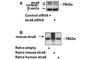 Image no. 1 for anti-Stimulated By Retinoic Acid 6 (STRA6) (C-Term) antibody (ABIN374801) (STRA6 anticorps  (C-Term))