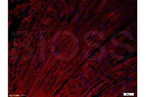 Formalin-fixed and paraffin embedded rat heart tissue labeled with Anti- Connexin-37/GJA4 Polyclonal Antibody, Unconjugated  at 1:200 followed by conjugation to the secondary antibody Goat Anti-Rabbit IgG, PE conjugated -PE) used at 1:200 dilution for 40 minutes at 37°C and DAPI.
