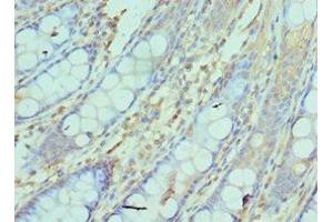 Immunohistochemistry of paraffin-embedded human colon tissue using ABIN7161752 at dilution of 1:100