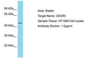 Image no. 1 for anti-Cat Eye Syndrome Chromosome Region, Candidate 5 (CECR5) (AA 353-402) antibody (ABIN6750600)