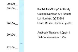 Western Blotting (WB) image for anti-Syntaxin Binding Protein 6 (Amisyn) (STXBP6) (N-Term) antibody (ABIN2785992) (STXBP6 anticorps  (N-Term))