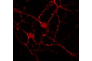 Indirect immunostaining of rat hippocampus neurons (dilution 1 : 100). (Doc 2a/b anticorps)