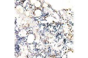 Immunohistochemistry of paraffin-embedded rat bone marrow using Neutrophil Elastase (ELANE) Rabbit pAb (ABIN6131604, ABIN6140110, ABIN6140111 and ABIN6216843) at dilution of 1:25 (40x lens).