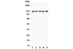 Western blot testing of C5a antibody and Lane 1:  rat liver;  2: mouse liver;  3: (m) NIH3T3;  4: (m) HEPA;  5: (r) PC12 lysate;  Predicted/Observed size: 115KD (C5A anticorps  (N-Term))