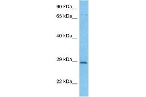 Host:  Rabbit  Target Name:  FBXW7  Sample Type:  721_B Whole Cell lysates  Antibody Dilution:  1. (FBXW7 anticorps  (C-Term))