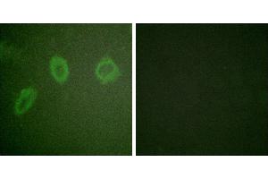 Peptide - +Immunofluorescence analysis of HuvEc cells, using ErbB2 antibody. (ErbB2/Her2 anticorps  (Internal Region))