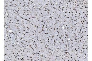 IHC analysis of DBC-1/CCAR2 using anti-DBC-1/CCAR2 antibody (ABIN7602235). (CCAR2 anticorps  (AA 65-917))