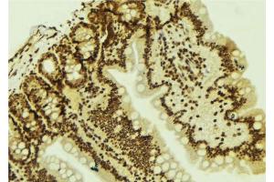ABIN6277777 at 1/100 staining Mouse colon tissue by IHC-P. (LEF1 anticorps  (Internal Region))