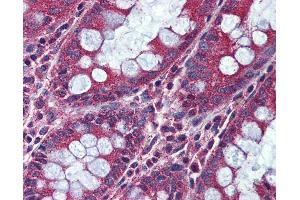 Anti-ACVR1C antibody IHC of human colon.