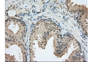 Immunohistochemical staining of paraffin-embedded Human liver tissue using anti-PDE4A mouse monoclonal antibody. (PDE4A anticorps)