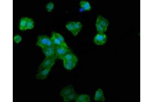 Immunofluorescence staining of HepG2 cells with ABIN7168260 at 1:133, counter-stained with DAPI. (RNF39 anticorps  (AA 200-321))