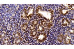 Detection of LXRb in Mouse Uterus Tissue using Polyclonal Antibody to Liver X Receptor Beta (LXRb)