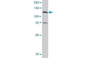CTNND2 polyclonal antibody (A01), Lot # 051116JC01 Western Blot analysis of CTNND2 expression in Hela S3 NE .