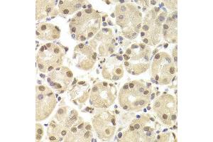 Immunohistochemistry of paraffin-embedded Human gastric using POU2F1 antibody at dilution of 1:100 (x400 lens). (POU2F1 anticorps  (AA 15-290))