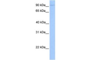 Western Blotting (WB) image for anti-ATP/GTP Binding Protein-Like 5 (AGBL5) antibody (ABIN2463607) (AGBL5 anticorps)