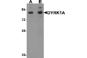 Western blot analysis of DYRK1A in HeLa cell lysate with DYRK1A antibody at (A) 1 and (B) 2 µg/mL.