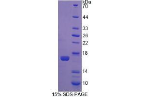 SDS-PAGE analysis of Rat CNR1 Protein. (CNR1 Protéine)