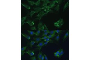 anti-Adenosine Deaminase (ADA) (AA 1-363) antibody