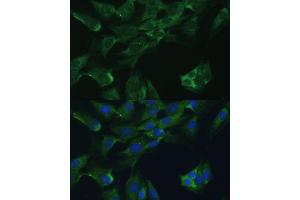 Immunofluorescence analysis of C6 cells using Adenosine Deaminase (Adenosine Deaminase (ADA)) antibody (ABIN3021281, ABIN3021282, ABIN3021283 and ABIN6214343) at dilution of 1:100. (ADA anticorps  (AA 1-363))